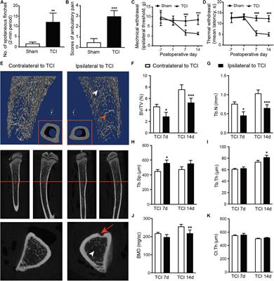 Distinct Gene Expression Patterns of Ion Channels and Cytokines in Rat Primary Sensory Neurons During Development of Bone Cancer and Cancer Pain